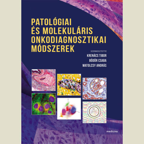 Patológiai és molekuláris onkodiagnosztikai módszerek